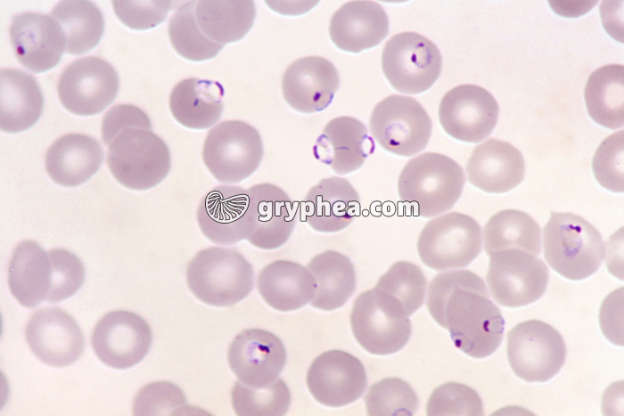 Plasmodium falciparum x400 - gryphea.org